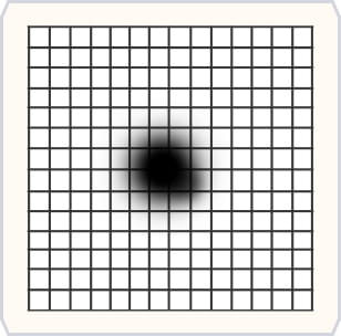 阿姆斯勒方格表 黑影盲點