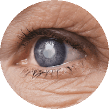 延誤治療有機會引起青光眼等併發症