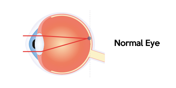 normal eye ball