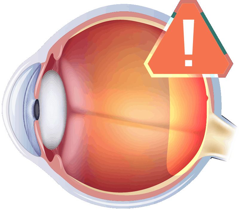 眼科專科 黃斑病變治療